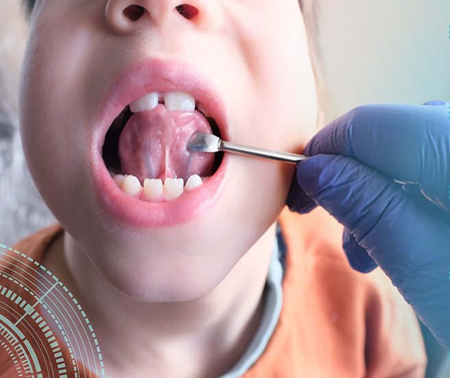 Dentist looking at patient’s tongue-tie