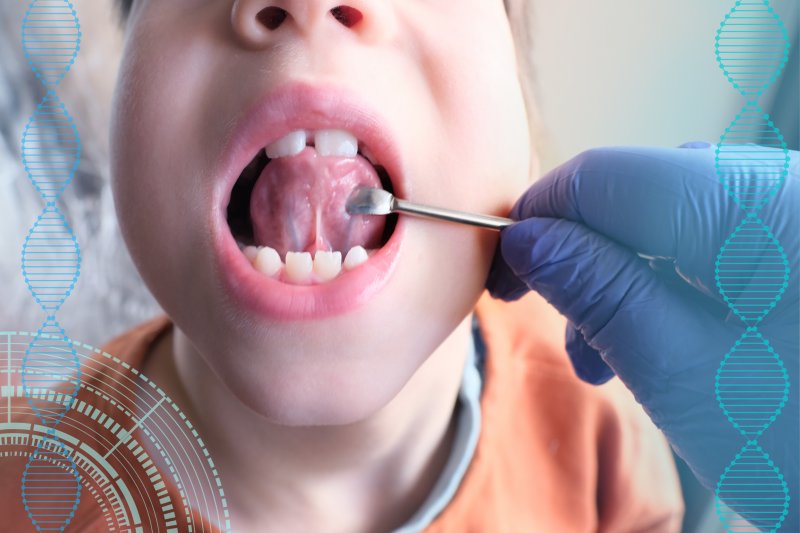 a child with a tongue-tie